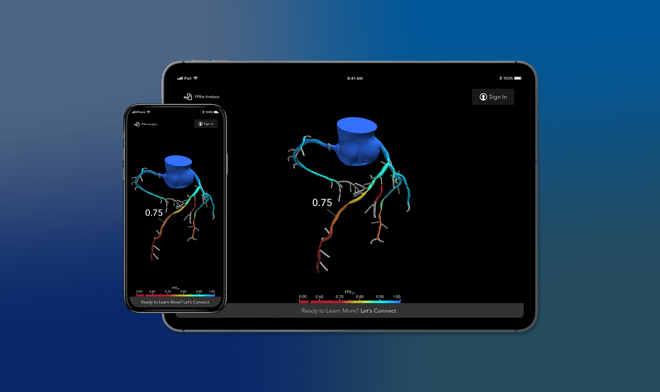 HeartFlow case study hero